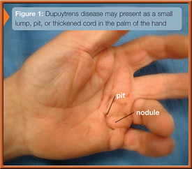 fig1
