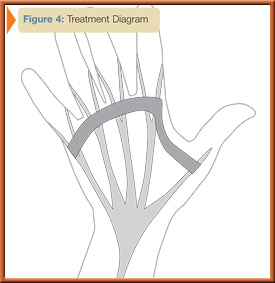 fig4